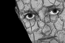 cracked-skin